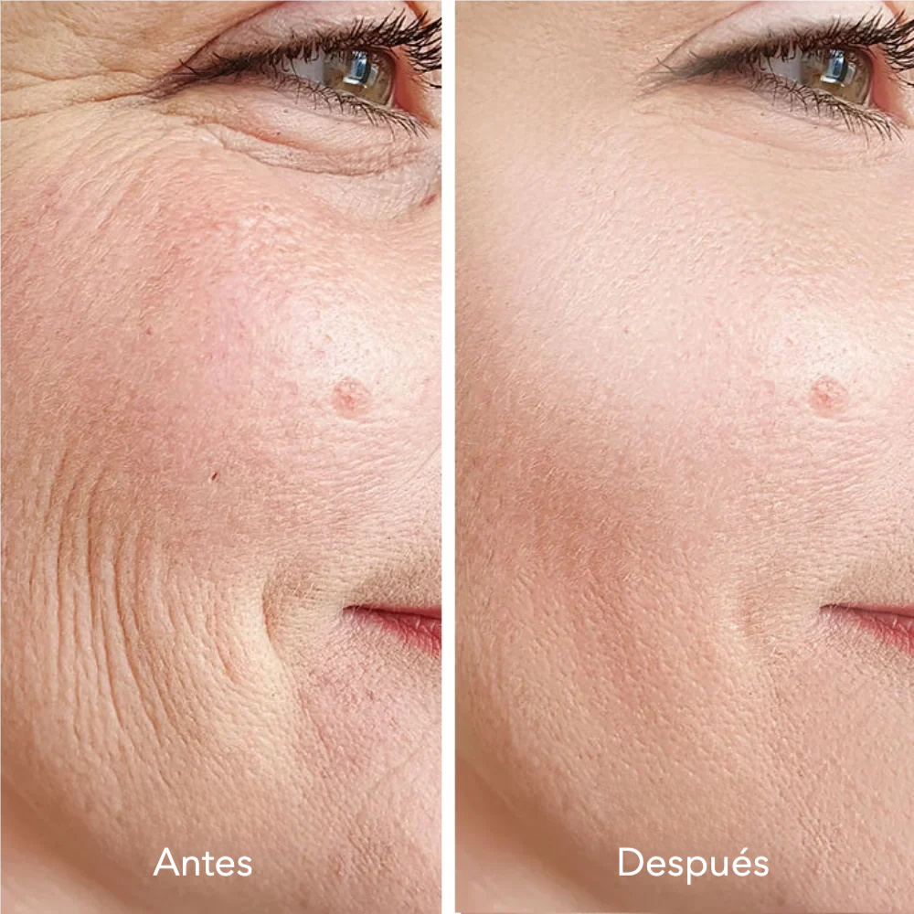 Mascarilla facial de Biocolágeno Élanéa